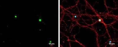 Immunocytochemistry/Immunofluorescence: TBR1 Antibody [NBP3-13178] - TBR1 antibody detects TBR1 protein by immunofluorescent analysis. Sample: DIV9 rat E18 primary hippocampal neuron cells were fixed in 4% paraformaldehyde at RT for 15 min. Green: TBR1 stained by TBR1 antibody (NBP3-13178) diluted at 1:500. Red: alpha Tubulin, stained by alpha Tubulin antibody [GT114] (NBP2-43837) diluted at 1:500. Blue: Fluoroshield with DAPI. Scale bar= 10um.