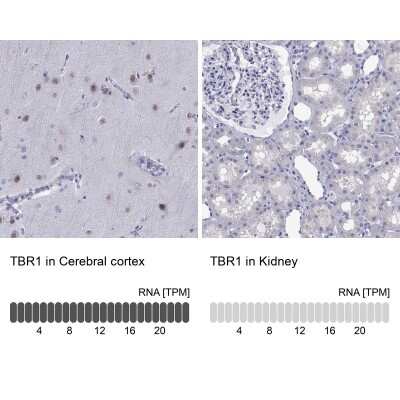 <b>Orthogonal Strategies Validation. </b>Immunohistochemistry-Paraffin: TBR1 Antibody [NBP2-62728] - Analysis in human cerebral cortex and kidney tissues using Anti-TBR1 antibody. Corresponding TBR1 RNA-seq data are presented for the same tissues.