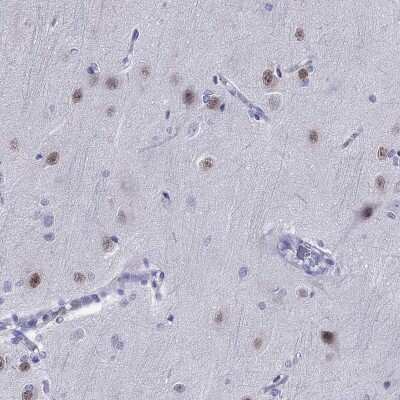 Immunohistochemistry-Paraffin: TBR1 Antibody [NBP2-62728] - Staining of human cerebral cortex shows high expression.