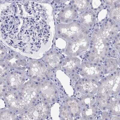 Immunohistochemistry-Paraffin: TBR1 Antibody [NBP2-62728] - Staining of human kidney shows low expression as expected.