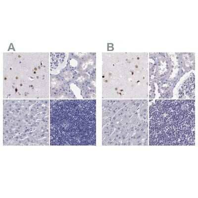 <b>Independent Antibodies Validation. </b>Immunohistochemistry-Paraffin: TBR1 Antibody [NBP2-62728] - Staining of human cerebral cortex, kidney, liver and lymph node using Anti-TBR1 antibody NBP2-62728 (A) shows similar protein distribution across tissues to independent antibody NBP2-62729 (B).