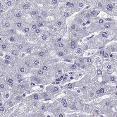 Immunohistochemistry-Paraffin: TBR1 Antibody [NBP2-62728] - Staining of human liver.