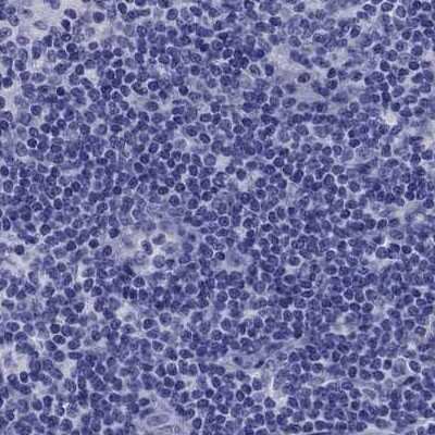 Immunohistochemistry-Paraffin TBR1 Antibody - BSA Free