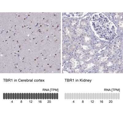 <b>Orthogonal Strategies Validation. </b>Immunohistochemistry-Paraffin: TBR1 Antibody [NBP2-62729] - Analysis in human cerebral cortex and kidney tissues using Anti-TBR1 antibody. Corresponding TBR1 RNA-seq data are presented for the same tissues.