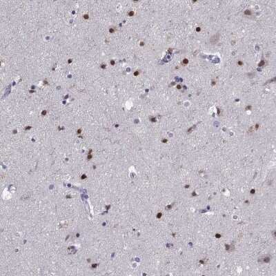 Immunohistochemistry-Paraffin: TBR1 Antibody [NBP2-62729] - Staining of human cerebral cortex shows high expression.