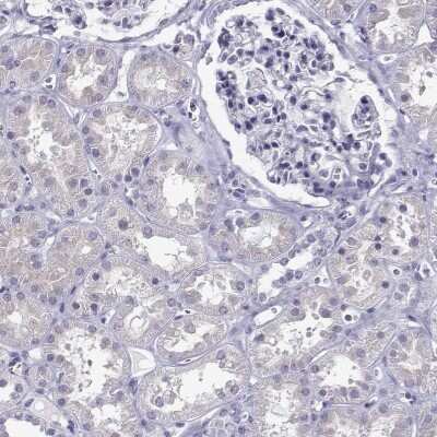 Immunohistochemistry-Paraffin: TBR1 Antibody [NBP2-62729] - Staining of human kidney shows low expression as expected.