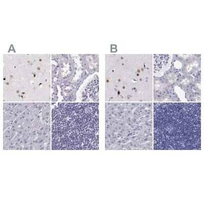 <b>Independent Antibodies Validation. </b>Immunohistochemistry-Paraffin: TBR1 Antibody [NBP2-62729] - Staining of human cerebral cortex, kidney, liver and lymph node using Anti-TBR1 antibody NBP2-62729 (A) shows similar protein distribution across tissues to independent antibody NBP2-62728 (B).