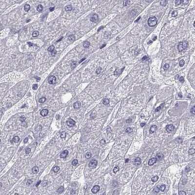 Immunohistochemistry-Paraffin: TBR1 Antibody [NBP2-62729] - Staining of human liver.