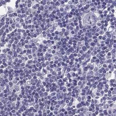 Immunohistochemistry-Paraffin: TBR1 Antibody [NBP2-62729] - Staining of human lymph node.