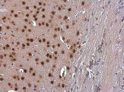 Immunohistochemistry-Paraffin: TBR1 Antibody [NBP3-13178] - TBR1 antibody detects TBR1 protein at nucleus by immunohistochemical analysis. Sample: Paraffin-embedded mouse brain. TBR1 stained by TBR1 antibody (NBP3-13178) diluted at 1:500. Antigen Retrieval: Citrate buffer, pH 6.0, 15 min