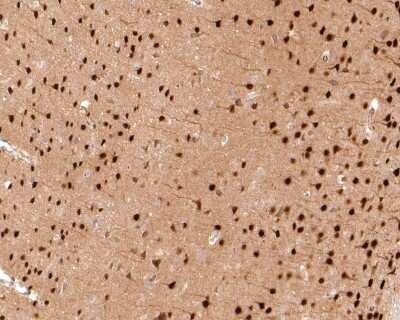 Immunohistochemistry-Paraffin: TBR1 Antibody (JF10-00) [NBP2-67184] - Analysis of paraffin-embedded rat brain tissue with Rabbit anti-TBR1 antibody washed with ddH2O and PBS, and then probed with the primary antibody  at 1/500 dilution for 1 hour at room temperature. The detection was performed using an HRP conjugated compact polymer system. DAB was used as the chromogen. Tissues were counterstained with hematoxylin and mounted with DPX.