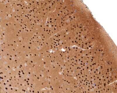 Immunohistochemistry-Paraffin: TBR1 Antibody (JF10-00) [NBP2-67184] - Analysis of paraffin-embedded mouse brain tissue with Rabbit anti-TBR1 antibody washed with ddH2O and PBS, and then probed with the primary antibody  at 1/500 dilution for 1 hour at room temperature. The detection was performed using an HRP conjugated compact polymer system. DAB was used as the chromogen. Tissues were counterstained with hematoxylin and mounted with DPX.