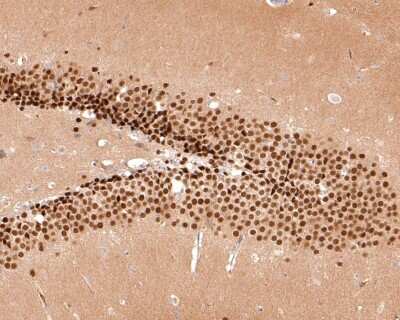 Immunohistochemistry-Paraffin: TBR1 Antibody (JF10-00) [NBP2-67184] - Analysis of paraffin-embedded mouse hippocampus tissue with Rabbit anti-TBR1 antibody washed with ddH2O and PBS, and then probed with the primary antibody  at 1/500 dilution for 1 hour at room temperature. The detection was performed using an HRP conjugated compact polymer system. DAB was used as the chromogen. Tissues were counterstained with hematoxylin and mounted with DPX.