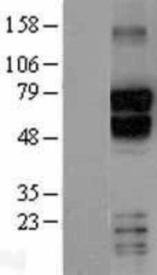 Western Blot TBR1 Overexpression Lysate