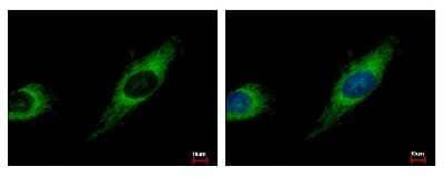 Immunocytochemistry/Immunofluorescence: TBRG4 Antibody [NBP2-20582] - Sample: HeLa cells were fixed in 4% paraformaldehyde at RT for 15 min. Green: TBRG4 protein stained by TBRG4 antibody diluted at 1:500. Blue: Hoechst 33343 staining.
