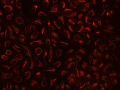 Immunocytochemistry/Immunofluorescence: TBRG4 Antibody [NBP2-98536] - Immunofluorescence staining of TBRG4 in U2OS cells. Cells were fixed with 4% PFA, permeabilzed with 0.1% Triton X-100 in PBS, blocked with 10% serum, and incubated with rabbit anti-Human TBRG4 polyclonal antibody (dilution ratio 1:200) at 4C overnight. Then cells were stained with the Alexa Fluor(R)594-conjugated Goat Anti-rabbit IgG secondary antibody (red). Positive staining was localized to Cytoplasm.