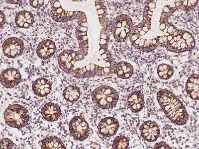 Immunohistochemistry-Paraffin: TBRG4 Antibody [NBP2-98536] - Immunochemical staining of human TBRG4 in human large intestine with rabbit polyclonal antibody at 1:100 dilution, formalin-fixed paraffin embedded sections.