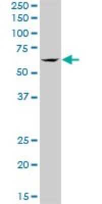 Western Blot: TBRG4 Antibody [H00009238-B01P] - Analysis of TBRG4 expression in HeLa.