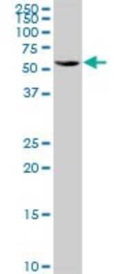 Western Blot: TBRG4 Antibody [H00009238-B01P] - Analysis of TBRG4 expression in HepG2.