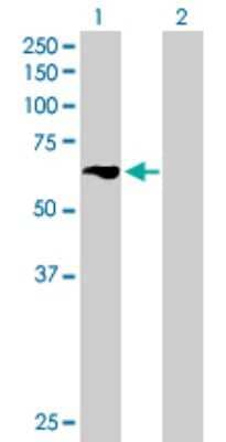 Western Blot: TBRG4 Antibody [H00009238-B01P] - Analysis of TBRG4 expression in transfected 293T cell line by TBRG4 polyclonal antibody.  Lane 1: TBRG4 transfected lysate(69.41 KDa). Lane 2: Non-transfected lysate.