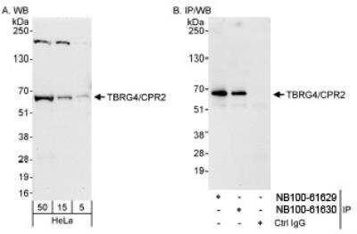 Western Blot: TBRG4 Antibody [NB100-61629] - Detection of Human TBRG4/CPR2 on HeLa whole cell lysate using NB100-61629. TBRG4/CPR2 was also immunoprecipitated by rabbit anti-TBRG4/CPR2 antibody  NB100-61630.