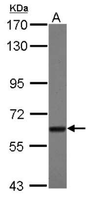 Western Blot: TBRG4 Antibody [NBP2-20582] - Sample (30 ug of whole cell lysate) A: A431 7. 5% SDS PAGE gel, diluted at 1:1000.