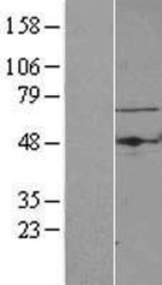 Western Blot: TBRG4 Overexpression Lysate (Adult Normal) [NBL1-16744] Left-Empty vector transfected control cell lysate (HEK293 cell lysate); Right -Over-expression Lysate for TBRG4.