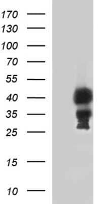 Western Blot: TBX1 Antibody (OTI1C2) - Azide and BSA Free [NBP2-74470] - Analysis of HEK293T cells were transfected with the pCMV6-ENTRY control (Left lane) or pCMV6-ENTRY TBX1.