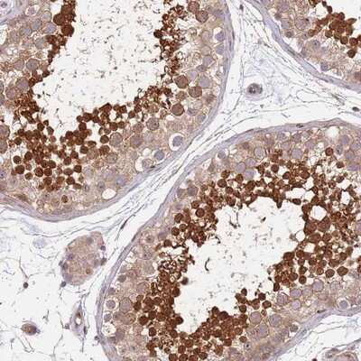 Immunohistochemistry-Paraffin: TBX10 Antibody [NBP2-13417] - Staining of human testis shows strong nuclear positivity in subset of cells in seminiferus ducts.