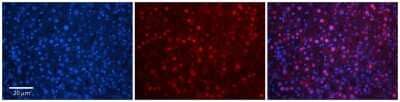 Immunohistochemistry-Paraffin: TBX10 Antibody [NBP2-85886] - Rabbit Anti-TBX10 Antibody. Formalin Fixed Paraffin Embedded Tissue: Human Adult Liver. Observed Staining: Nuclear in hepatocytes, strong signal, wide tissue distribution. Primary Antibody Concentration: 1:100. Secondary Antibody: Donkey anti-Rabbit-Cy3. Secondary Antibody Concentration: 1:200. Magnification: 20X.