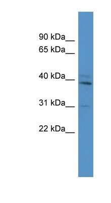 Western Blot: TBX10 Antibody [NBP1-68982] - Titration: 0.2-1 ug/ml, Positive Control: Mouse Brain.