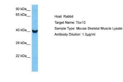 Western Blot: TBX10 Antibody [NBP2-85886] - Host: Mouse. Target Name: TBX10. Sample Tissue: Mouse Skeletal Muscle. Antibody Dilution: 1ug/ml