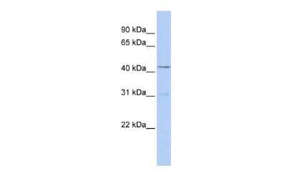 Western Blot: TBX10 Antibody [NBP2-85887] - WB Suggested Anti-TBX10 Antibody Titration: 0.2-1 ug/ml. ELISA Titer: 1:62500. Positive Control: Jurkat cell lysate