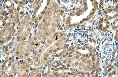 Immunohistochemistry TBX15 Antibody - BSA Free