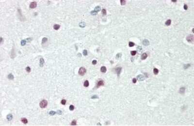 Immunohistochemistry: TBX15 Antibody [NBP2-83624] - Human Brain, Cortex: Formalin-Fixed, Paraffin-Embedded (FFPE). This image was taken for the unconjugated form of this product. IHC - Paraffin (10 Âµg/ml).