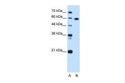 Western Blot: TBX15 Antibody [NBP2-83624] - WB Suggested Anti-TBX15 Antibody Titration: 1.25ug/ml. Positive Control: Jurkat cell lysate