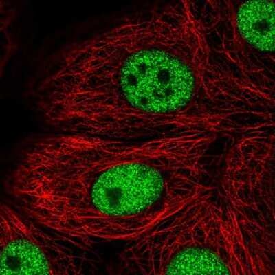 Immunocytochemistry/Immunofluorescence: TBX2 Antibody [NBP1-89459] - Staining of human cell line MCF7 shows localization to nucleoplasm. Antibody staining is shown in green.