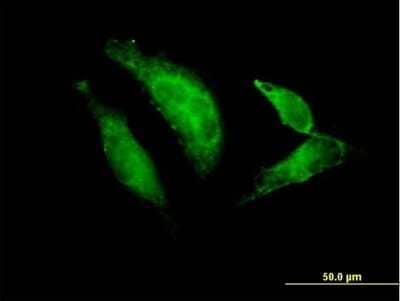 Immunocytochemistry/Immunofluorescence: TBX20 Antibody [H00057057-B01P] - Analysis of purified antibody to TBX20 on HeLa cell. (antibody concentration 10 ug/ml)