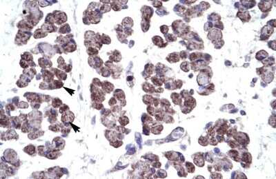 Immunohistochemistry: TBX20 Antibody [NBP2-86846] - Human Muscle