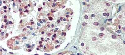 Immunohistochemistry: TBX20 Antibody [NBP2-86846] - Immunohistochemistry with Human kidney lysate tissue at an antibody concentration of 5.0ug/ml using anti-TBX20 antibody