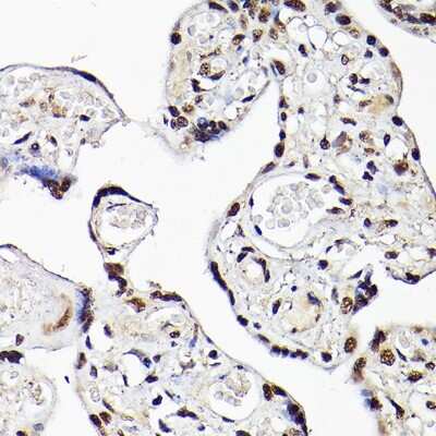 Immunohistochemistry-Paraffin: TBX20 Antibody [NBP2-93256] - Human placenta using TBX20 Rabbit pAb (NBP2-93256) at dilution of 1:100 (40x lens). Perform high pressure antigen retrieval with 10 mM citrate buffer pH 6.0 before commencing with IHC staining protocol.