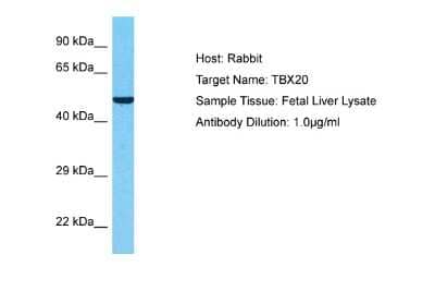 Western Blot: TBX20 Antibody [NBP2-86845] - Host: Rabbit. Target Name: TBX20. Sample Type: Fetal Liver lysates. Antibody Dilution: 1.0ug/ml