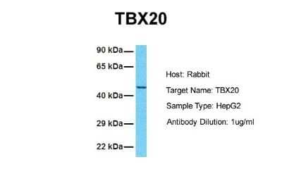 Western Blot: TBX20 Antibody [NBP2-86846] - Host: Rabbit. Target Name: TBX20. Sample Tissue: Human HepG2. Antibody Dilution: 1.0ug/ml