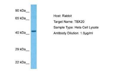 Western Blot: TBX20 Antibody [NBP2-86846] - Host: Rabbit. Target Name: TBX20. Sample Tissue: Human Hela Whole Cell. Antibody Dilution: 2ug/ml