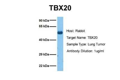 Western Blot: TBX20 Antibody [NBP2-86847] - Host: Rabbit. Target Name: TBX20. Sample Tissue: Human Lung Tumor. Antibody Dilution: 1.0ug/ml