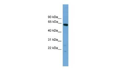 Western Blot: TBX22 Antibody [NBP2-86851] - WB Suggested Anti-Tbx22 Antibody Titration: 0.2-1 ug/ml. Positive Control: Mouse Brain