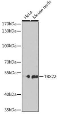 Western Blot: TBX22 Antibody [NBP2-94171] - Western blot analysis of extracts of various cell lines, using TBX22 antibody at 1:1000 dilution. Secondary antibody: HRP Goat Anti-Rabbit IgG (H+L) at 1:10000 dilution. Lysates/proteins: 25ug per lane. Blocking buffer: 3% nonfat dry milk in TBST.Detection: ECL Basic Kit. Exposure time: 90s.