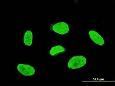 Immunocytochemistry/Immunofluorescence: TBX3 Antibody (7B3) [H00006926-M08] - Analysis of monoclonal antibody to TBX3 on HeLa cell. Antibody concentration 10 ug/ml.