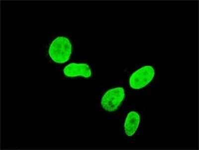 Immunocytochemistry/Immunofluorescence: TBX3 Antibody (7H6) [H00006926-M03] - Analysis of monoclonal antibody to TBX3 on HeLa cell. Antibody concentration 10 ug/ml