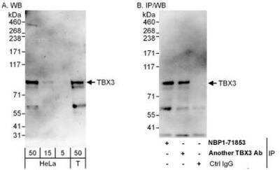 Western Blot: TBX3 Antibody [NBP1-71853] - Whole cell lysate from HeLa (5, 15 and 50 mcg for WB; 1 mg for IP, 20% of IP loaded) and 293T (T; 50 mcg) cells.  Affinity purified rabbit anti-TBX3 antibody used for WB at 0.4 mcg/ml (A) and 1 mcg/ml (B) and used for IP at 6 mcg/mg lysate.  TBX3 was also immunoprecipitated by another rabbit anti-TBX3 antibody which recognizes a downstream epitope.